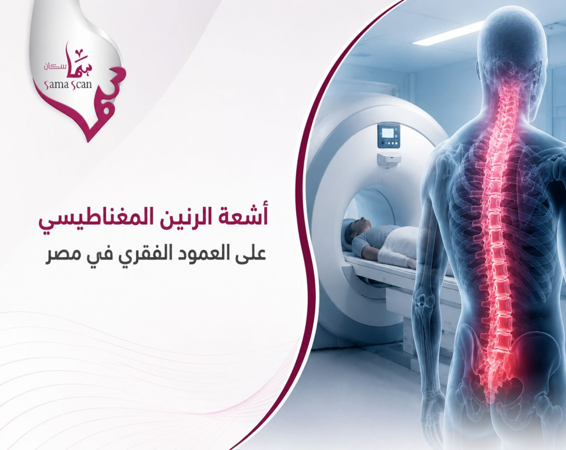 blog-image